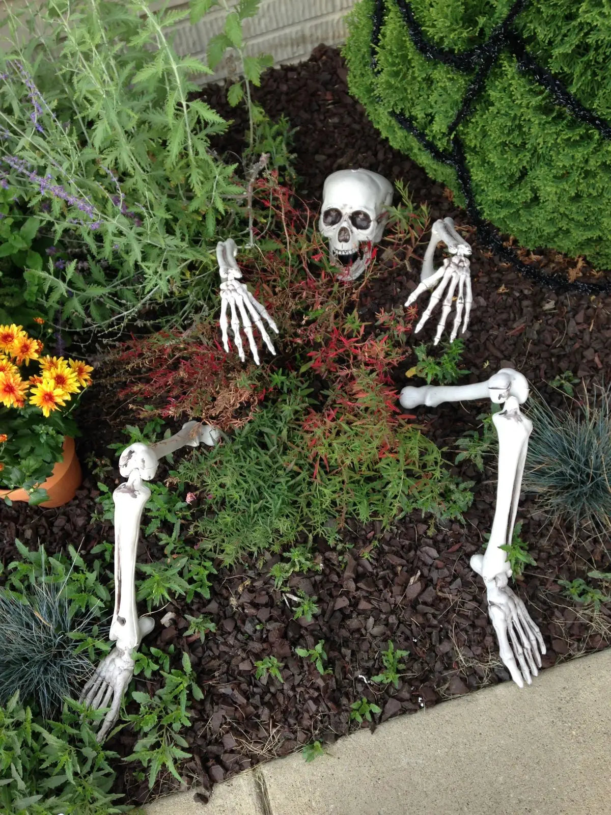 Skeleton Stakes – Realistic Skull & Hand Arms for Halloween Decor